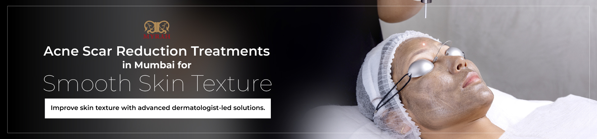 Acne Scar Reduction Treatments in Mumbai for Smooth Skin Texture
