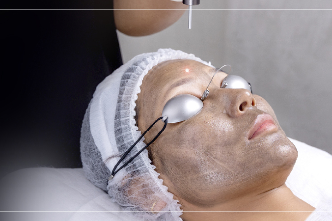 Acne Scar Reduction Treatments in Mumbai for Smooth Skin Texture