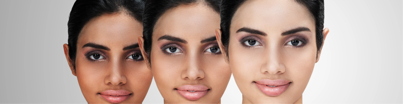 Luxury Pigmentation & Skin Brightening Treatment in Mumbai | Myrah Wellness