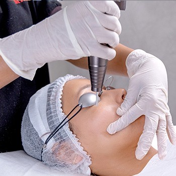 UNDEREYE LASER TONING